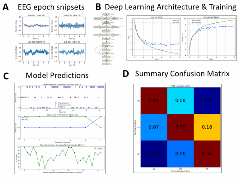 Read more about the article PREDICTING EEG PATHOLOGY VIA DEEP LEARNING ANALYSIS: A TOOL FOR NEUROLOGICAL AND PSYCHIATRIC ILLNESSES