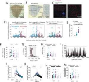 Read more about the article NEURONS FIRE IN EARLY ALZHEIMER’S LINKING ELECTROPHYSIOLOGY TO MICROGLIAL STATES