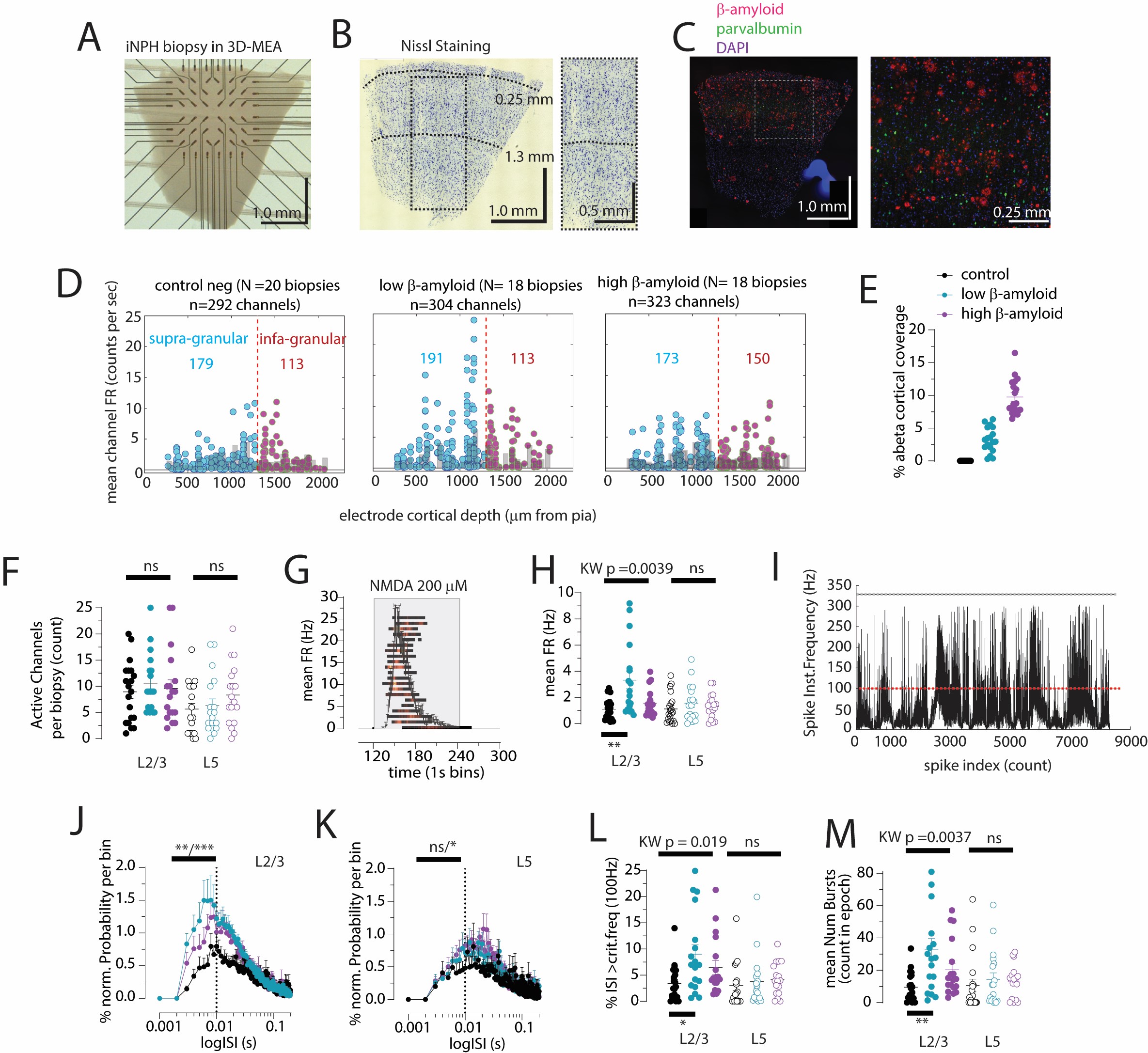 You are currently viewing NEURONS FIRE IN EARLY ALZHEIMER’S LINKING ELECTROPHYSIOLOGY TO MICROGLIAL STATES